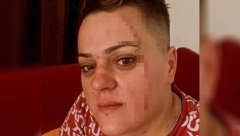 PRETUČENA BIVŠA UČESNICA RIJALITIJA?! Sanju davila i udarala sestra nestale Marijane iz Velikog brata, isplivali svi skandalozni detalji