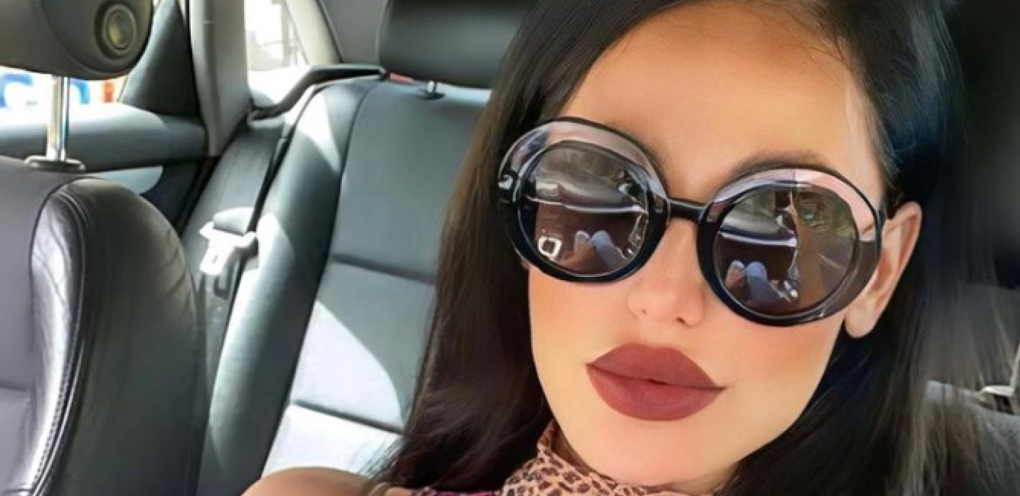 GORELE DRUŠTVENE MREŽE Pevačica nakon zdravstvene drame smršala 40 kilograma, a njeno izdanje u kupaćem kostimu oduzima dah (FOTO)