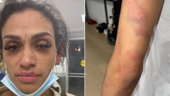 "NE MOGU VIŠE DA ĆUTIM! IMAM FRAKTURU NOSA, POTRES MOZGA, DECA SU SVEDOČILA": Žena NBA košarkaša optužila muža za nasilje, iznela je jezive detalje