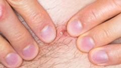 ZBOG URASLE DLAKE PROVEO JE ČETIRI MESECA U KOMI Lekari su se satima borili za njegov život, evo kad ovo može da bude smrtonosna