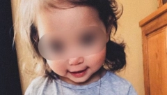 SVAKI MINUT MOŽE DA OSTANE BEZ VIDA Ljudi ne mogu da odole njenim očima, a ne znaju da je to simptom neizlečive bolesti