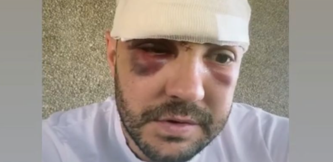 INFLUENSERA POTERAO MALER Jovan Radulović pre nekoliko dana doživeo je nezgodu, a sada je njegova ćerka u bolnici: MOJA BEKA JE LAV NAJJAČI! (FOTO)