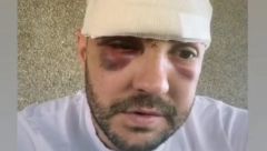 INFLUENSERA POTERAO MALER Jovan Radulović pre nekoliko dana doživeo je nezgodu, a sada je njegova ćerka u bolnici: MOJA BEKA JE LAV NAJJAČI! (FOTO)