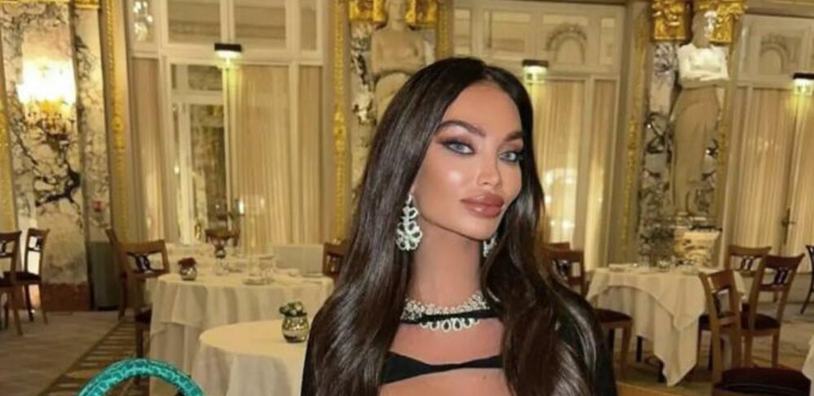 SORAJA VUČELIĆ PRE SVIH OPERACIJA Potpuno druga osoba, niko je ne bi prepoznao! (FOTO)