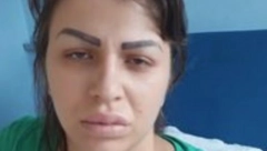 LEKARI USTANOVILI JOŠ JEDAN POREMEĆAJ MILJANI KULIĆ Evo o čemu je reč i kako se dobija