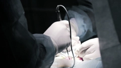 REVOLUCIONARNA VEST Svinjski bubreg u čoveku, hirurzi imaju novu nadu - "Izgleda bolje od ljudskog"