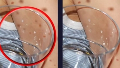 TEST SA ČAŠOM MOŽE DA SPASI ŽIVOT VAŠEM DETETU Mnogo dece umiru od ove opasne infekcije, ako primetite ovu promenu, odmah se uputite u bolnicu
