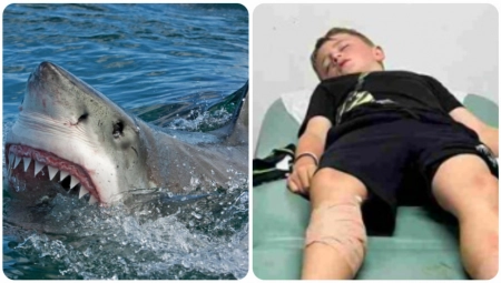 DEČAKA NAPALA TRI MORSKA PSA Sestra ga je spasila sigurne smrti, a kako joj je to pošlo za rukom