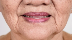 VAŠA USTA OTKRIVAJU BOLESTI Zubar ističe stvari koje ne primećujete, a govore o stanju organizma, u jednom slučaju momentalno posetite lekara