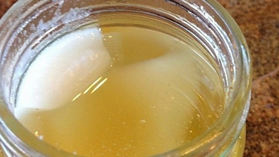 MUČITE MUKU SA SINUSIMA Probajte narodni recept od 2 sastojka koji će oterati bol i pritisak u glavi