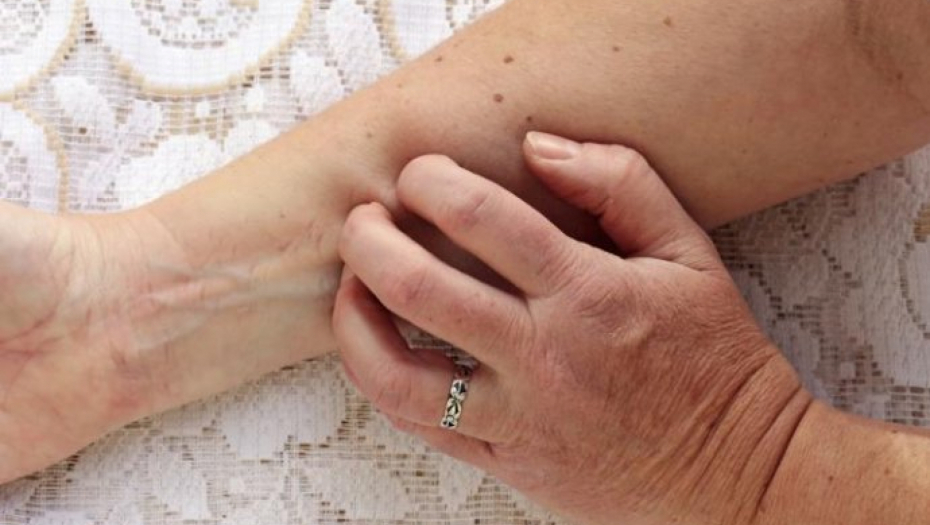 OBRATITE PAŽNU NA SIMPTOME Ovo su sigurni znaci da je došlo do oštećenja jetre