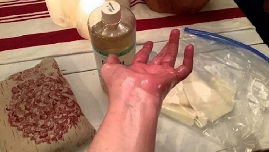 PROVERENO DELUJE Namazala je ovo ulje na bolne zglobove, ujutru nije mogla da veruje šta se desilo