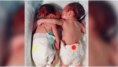 DOKTORI SU VEĆ DIGLI RUKE Babica je stavila umiruću bebu pored sestre, onda se desilo čudo