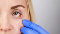 SIMPTOM NAJSMRTONOSNIJEG TUMORA MOŽE DA SE VIDI POVLAČENJEM OČNOG KAPKA Ovu opasnu bolest najbitnije je na vreme uočiti!