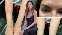 PROCURILI ŠOK DETALJI IZ SPLITA Otkriveni pravi razlozi tuče Severine i njene sestre, istina je potpuno drugačija