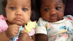 BILE SU PRAVA SENZACIJA U SVETU Pogledajte kako danas izgledaju najpoznatije bliznakinje koje imaju različitu boju kože