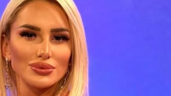 ALEKS PRVI PUT PRED KAMERAMA NAKON OPERACIJE Aleksandra šokirala sve ovim komentarom, nosila je masku kako bi sakrila lice (FOTO)