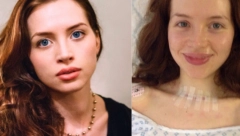 NA FOTOGRAFIJI SE JASNO VIDI SIMPTOM KANCERA Podmukao je i mnogi ne primete ništa dok ne uđe u ZAVRŠNU fazu