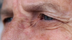 UKAZUJE NA RAK ŽELUCA, A JAVLJA SE U OČIMA: Mnogi ne primete ovaj neobičan simptom, a siguran je znak opake bolesti