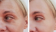 ZOVU GA NAJBOLJIM "LEKOM" PROTIV BORA Žene kažu zbogom botoksu, ovo ulje je efikasnije i jeftinije