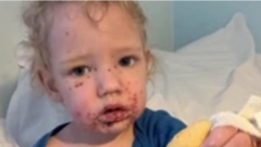 ISPOVEST OČAJNE MAJKE: Dva puta su dečaka vraćali iz bolnice i govorili da je sve u redu, dečak je umalo oslepeo zbog greške koju pravi svaki roditelj