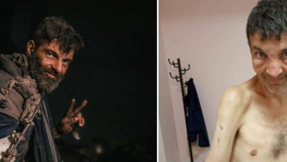 IZDEFORMISAN I NEPREPOZNATLJIV Evo kako sada izgleda "pijanista", borac zloglasnog AZOV-a (FOTO)