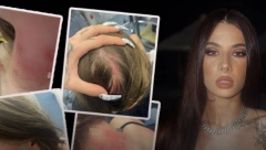 BORILA SE ZA ŽIVOT! Prvo oglašavanje majke Uki Q nakon što joj je ćerka pretučena