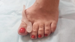 OPERACIJA NIJE JEDINO REŠENJE Jedna biljka rešava problem čukljeva, žene se kunu u ovaj napitak