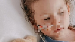 IMALA ČUDNE FLEKE NA JEZIKU I OSIP PO CELOM TELU: Lekari su rekli da devojčica boluje od smrtonosne bolesti, roditelji su rizikovali kako bi se izlečila