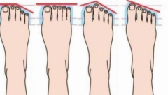 IZGLED VAŠIH PRSTIJU OTKRIVA SUDBINU Ako vam je drugi prst veći od ostalih, blago vama