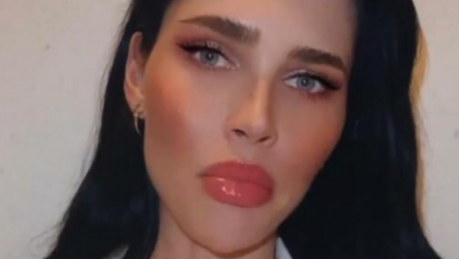 OTKRIVENO U KAKVOM JE STANJU DENIZ DEJM Nakon što je pretučena, lekari ustanovili ove povrede!