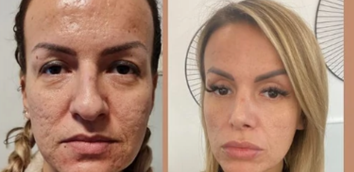 ŠOK TRANSFORMACIJA Operacije joj promenile lični opis, prevazišla i Maju Marinković (FOTO)