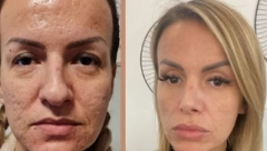 ŠOK TRANSFORMACIJA Operacije joj promenile lični opis, prevazišla i Maju Marinković (FOTO)