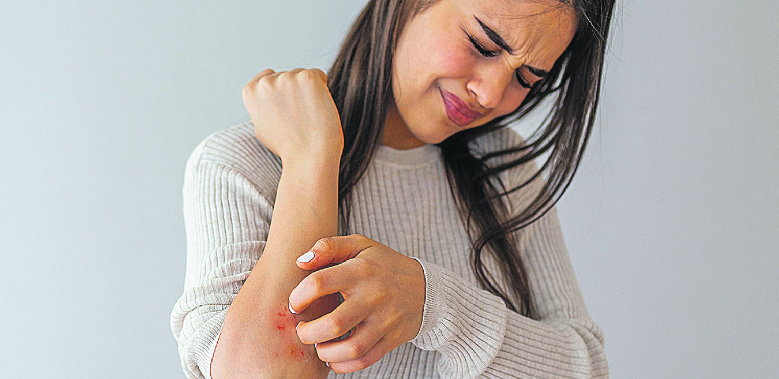 OD SVRABA DO INFARKTA Psorijaza je uporno kožno oboljenje za koje ne postoji lek, ali se može značajno ublažiti