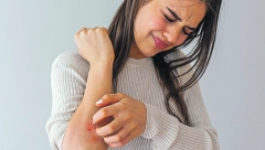 NAPADAJU PREPONE, TRBUH I GRUDI! Ovim gljivicama najviše odgovaraju tropske vrućine - bitno upozorenje dermatologa!