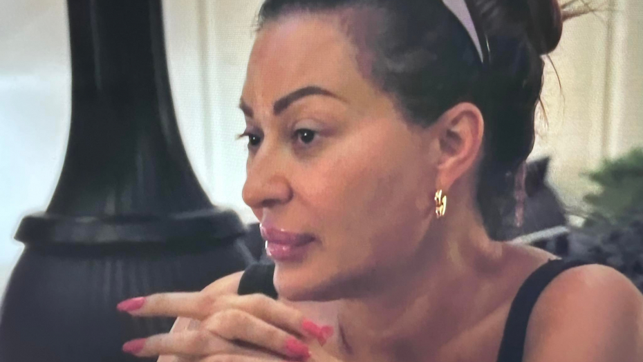 BEZ TRUNKE ŠMINKE Evo kako je izgledala Ceca neposredno pred operaciju (FOTO)