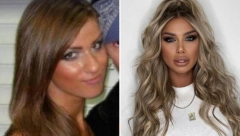 PROMENILA LIČNI OPIS Ivana Nikolić progovorila o estetskim operacijama, pa priznala koje je sve zahvate radila