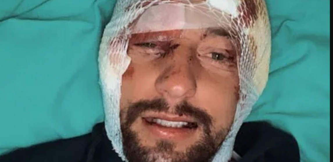 OGLASIO SE NAKON SAOBRAĆAJKE: Evo u kakvom je stanju bivši zadrugar, sledi oporavak (FOTO)