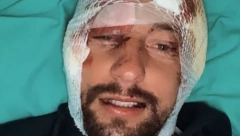 OGLASIO SE NAKON SAOBRAĆAJKE: Evo u kakvom je stanju bivši zadrugar, sledi oporavak (FOTO)
