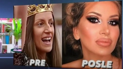 PLASTIČNI HIRURG RAZOTKRIO NAŠE POZNATE DAME: Evo šta se sve operisale, Dalila Dragojević promenila lični opis, ali nije jedina! TU SU I FOTKE!