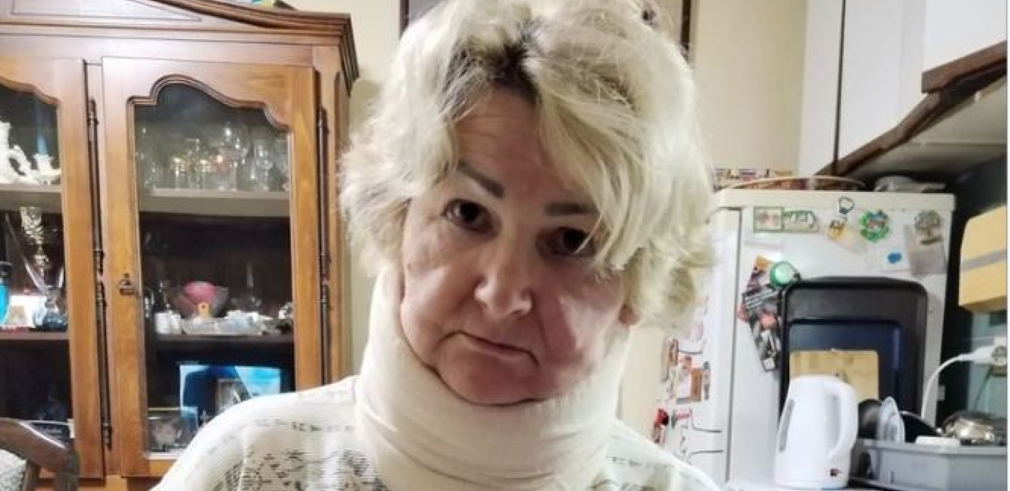 NISAM ZNALA ŠTA ME SNAŠLO, SVE ZVEZDE SAM VIDELA Oglasila se Snežana (60) koja je brutalno pretučena na maloj pijaci na Karaburmi