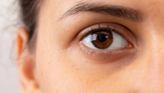 PRVI SIMPTOM SRČANOG UDARA VIDI SE U OČIMA Javlja se pet godina ranije, ako ga primetite obavezno se javite lekaru!