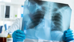 BOLE VAS PLUĆA? Doktor upozorava, ovo je glavna razlika prehlade i teške upale!