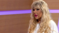 DRŽAĆETE SE ZA GLAVU KADA VIDITE KAKO JE JAMI IZGLEDALA PRE SVIH OPERACIJA Ni rođena majka je ne bi prepoznala, sva se IZOBLIČILA (FOTO)