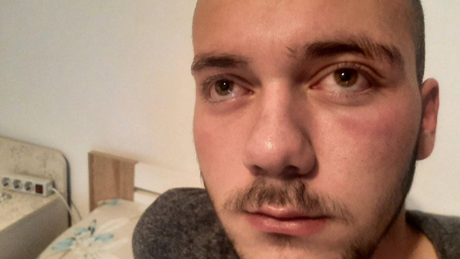 UŽASNI DETALJI NAPADA NA STEFANA! Šiptari ga zaskočili na ulici, a onda je počeo teror Kurtijeve policije!