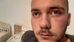 UŽASNI DETALJI NAPADA NA STEFANA! Šiptari ga zaskočili na ulici, a onda je počeo teror Kurtijeve policije!