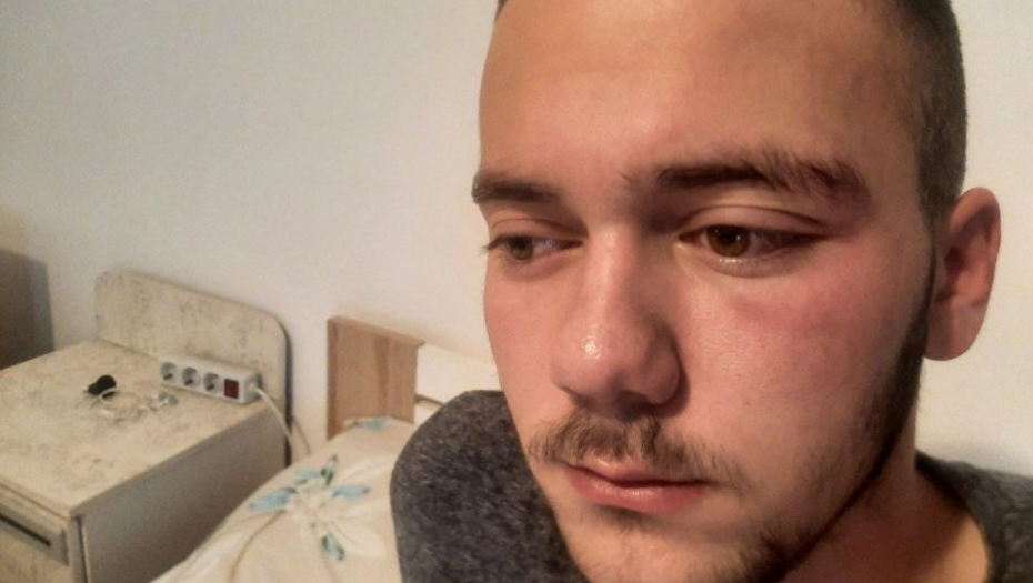"OVO JE HAOS, NE ZNAM VIŠE ŠTA DA RADIM" Oglasio se otac povređenog srpskog mladića