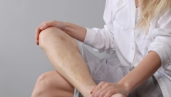 Ne ignorišite: Bol u nogama može da upozori na visok nivo holesterola