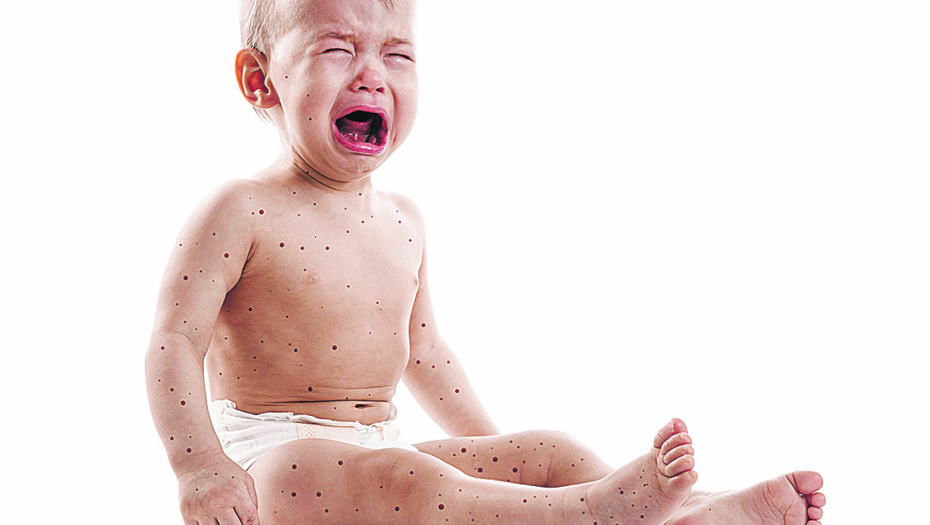 Antivakseri se opamete tek kad krene epidemija!