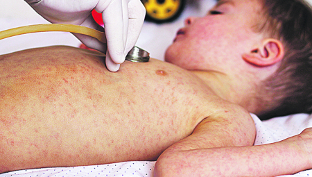 Male boginje se šire!